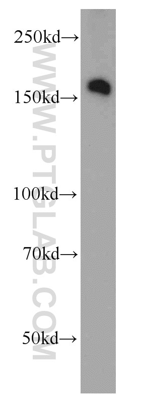 Western Blot (WB) analysis of HT-1080 cells using ROCK2(middle) Polyclonal antibody (21645-1-AP)