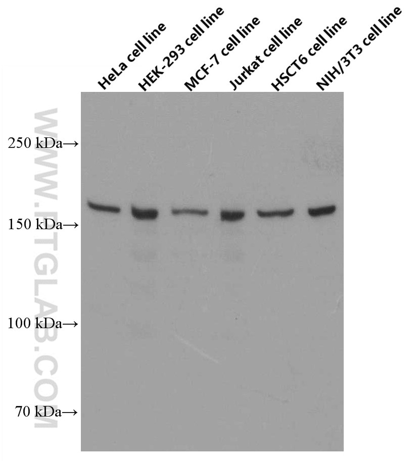 Western Blot (WB) analysis of various lysates using ROCK2 Monoclonal antibody (66633-1-Ig)