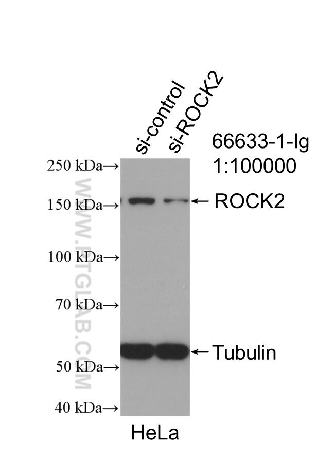 Western Blot (WB) analysis of HeLa cells using ROCK2 Monoclonal antibody (66633-1-Ig)