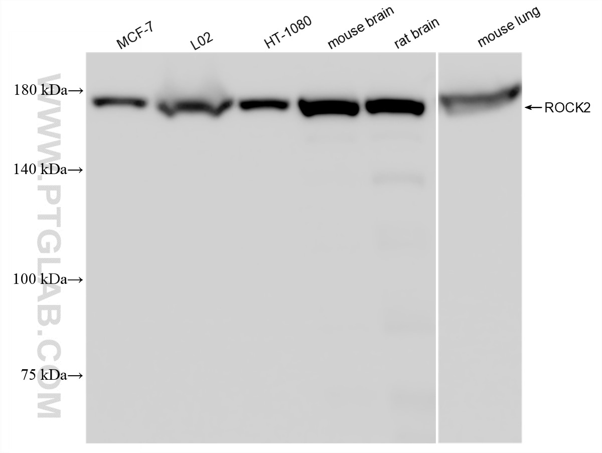 Western Blot (WB) analysis of various lysates using ROCK2(middle) Recombinant monoclonal antibody (86649-4-RR)