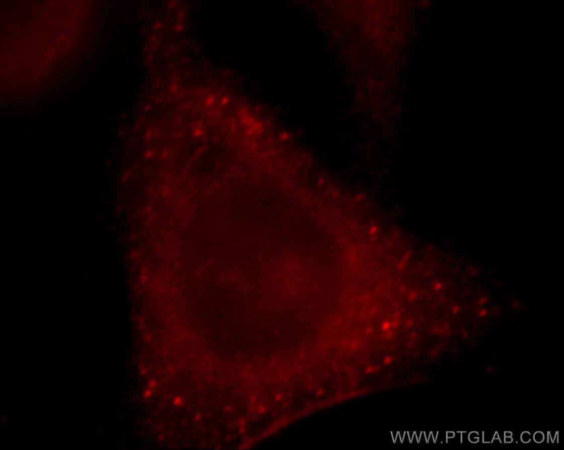 Immunofluorescence (IF) / fluorescent staining of HepG2 cells using ROCK2-Specific(C-term) Polyclonal antibody (20248-1-AP)
