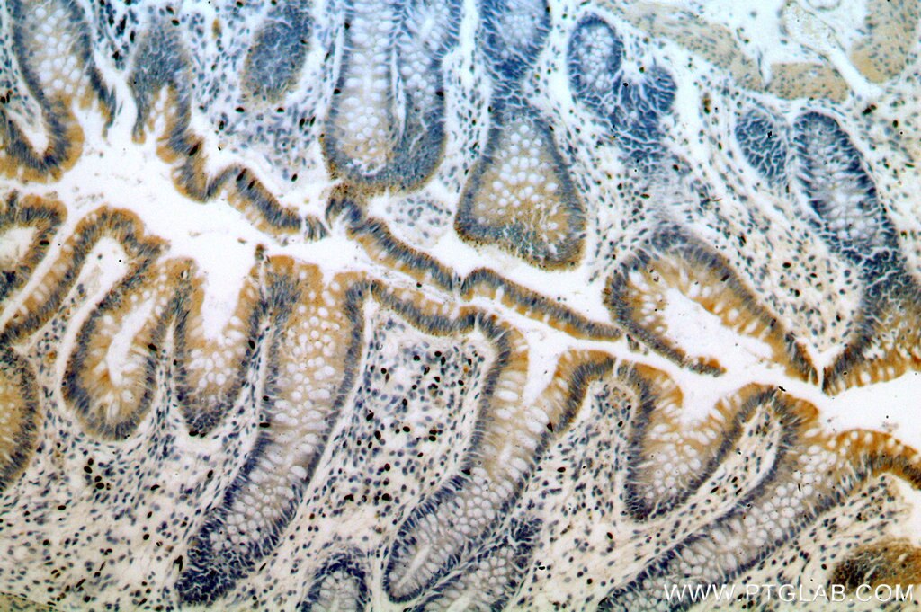 Immunohistochemistry (IHC) staining of human colon tissue using ROCK2-Specific(C-term) Polyclonal antibody (20248-1-AP)