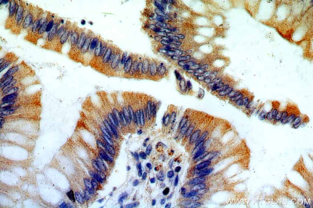 Immunohistochemistry (IHC) staining of human colon tissue using ROCK2-Specific(C-term) Polyclonal antibody (20248-1-AP)