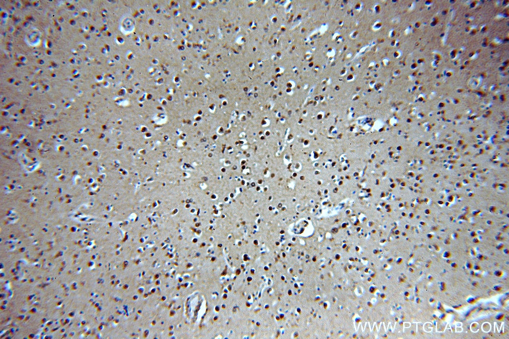 Immunohistochemistry (IHC) staining of human brain tissue using ROCK2-Specific(C-term) Polyclonal antibody (20248-1-AP)