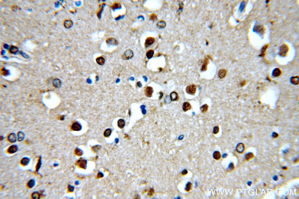 Immunohistochemistry (IHC) staining of human brain tissue using ROCK2-Specific(C-term) Polyclonal antibody (20248-1-AP)