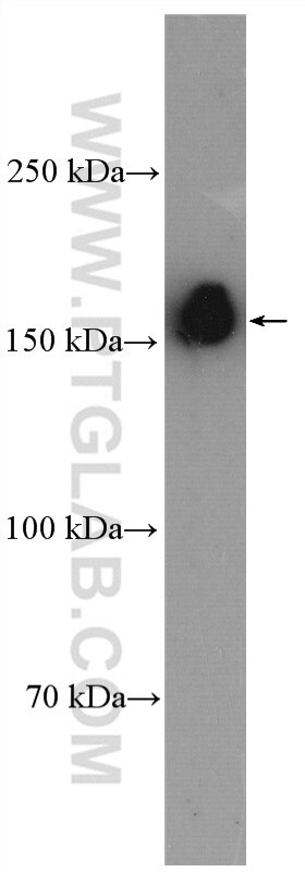 Western Blot (WB) analysis of mouse brain tissue using ROCK2-Specific(C-term) Polyclonal antibody (20248-1-AP)