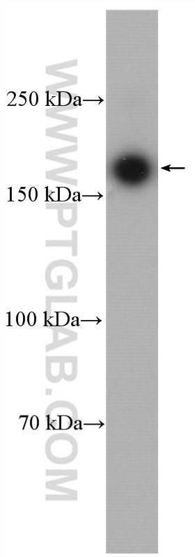 Western Blot (WB) analysis of rat brain tissue using ROCK2-Specific(C-term) Polyclonal antibody (20248-1-AP)