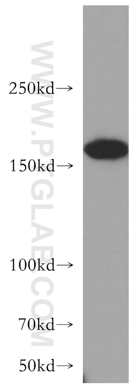 Western Blot (WB) analysis of HeLa cells using ROCK2-Specific(C-term) Polyclonal antibody (20248-1-AP)