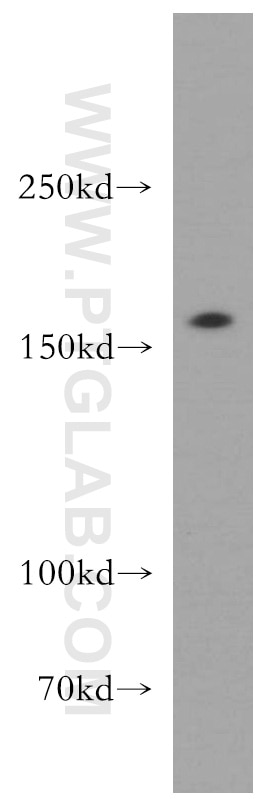 Western Blot (WB) analysis of mouse brain tissue using ROCK2-Specific(C-term) Polyclonal antibody (20248-1-AP)