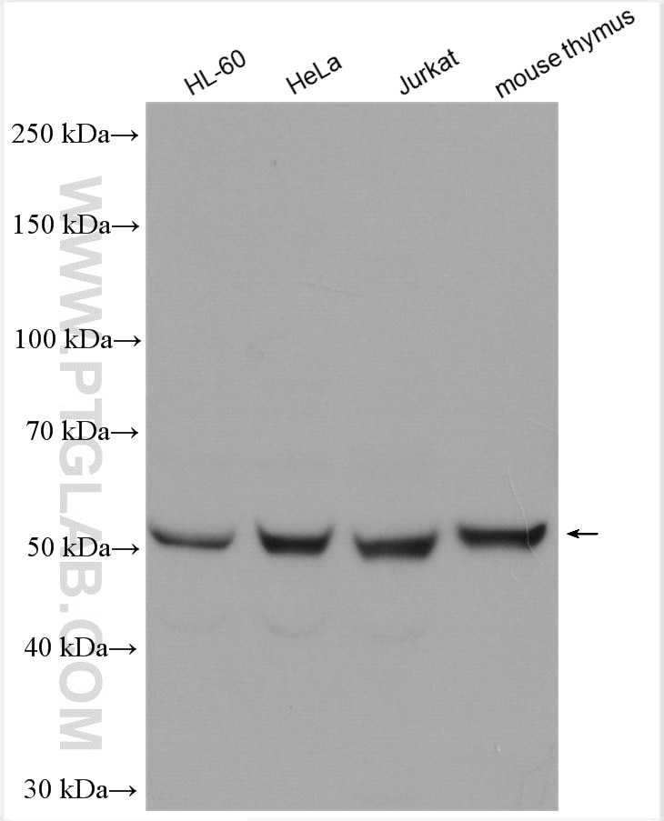 Western Blot (WB) analysis of various lysates using ROD1 Polyclonal antibody (14027-1-AP)