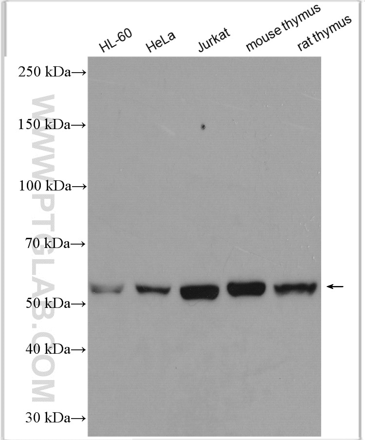 Western Blot (WB) analysis of various lysates using ROD1 Polyclonal antibody (14027-1-AP)