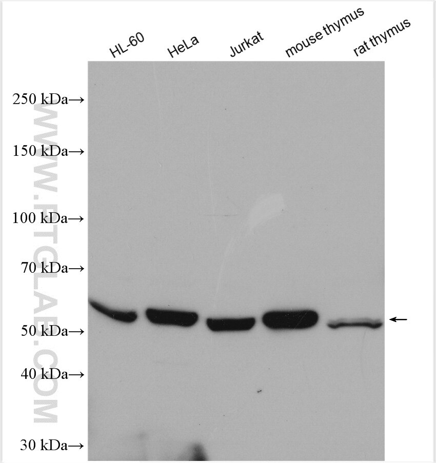 Western Blot (WB) analysis of various lysates using ROD1 Polyclonal antibody (14027-1-AP)