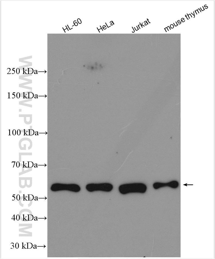 Western Blot (WB) analysis of various lysates using ROD1 Polyclonal antibody (14027-1-AP)