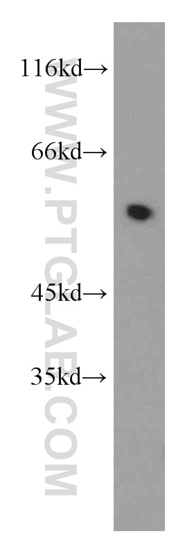 WB analysis of mouse thymus using 14027-1-AP