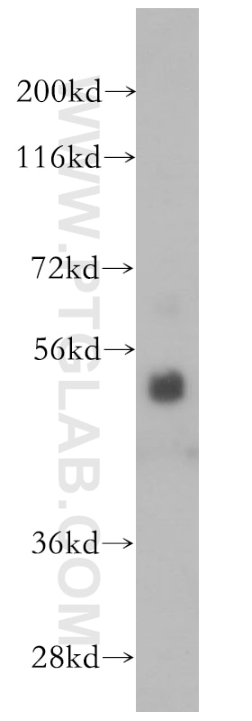 Western Blot (WB) analysis of HL-60 cells using ROD1 Polyclonal antibody (14027-1-AP)