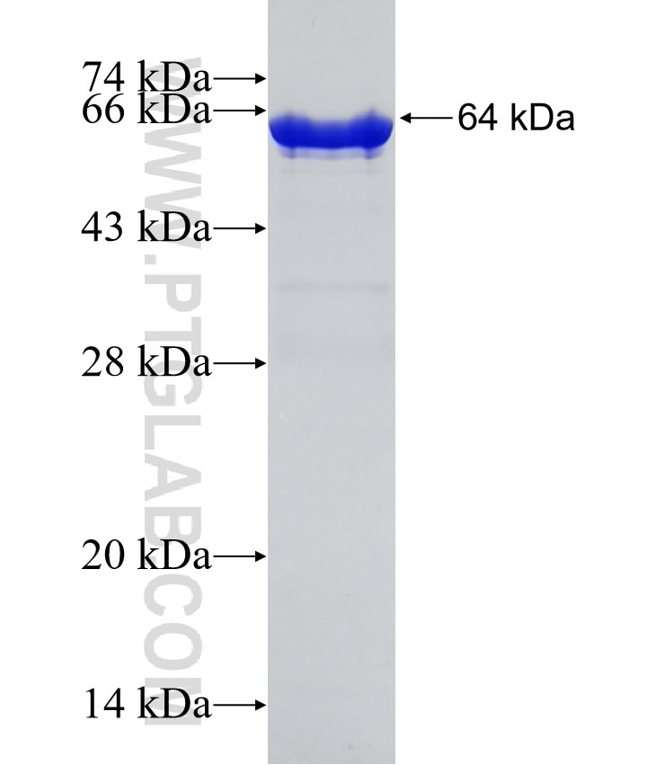 ROD1 fusion protein Ag5172 SDS-PAGE