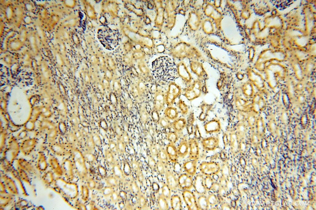 Immunohistochemistry (IHC) staining of human kidney tissue using ROGDI Polyclonal antibody (17047-1-AP)