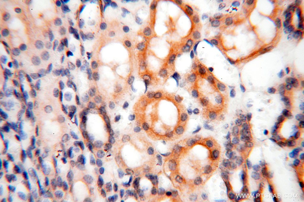 Immunohistochemistry (IHC) staining of human kidney tissue using ROGDI Polyclonal antibody (17047-1-AP)