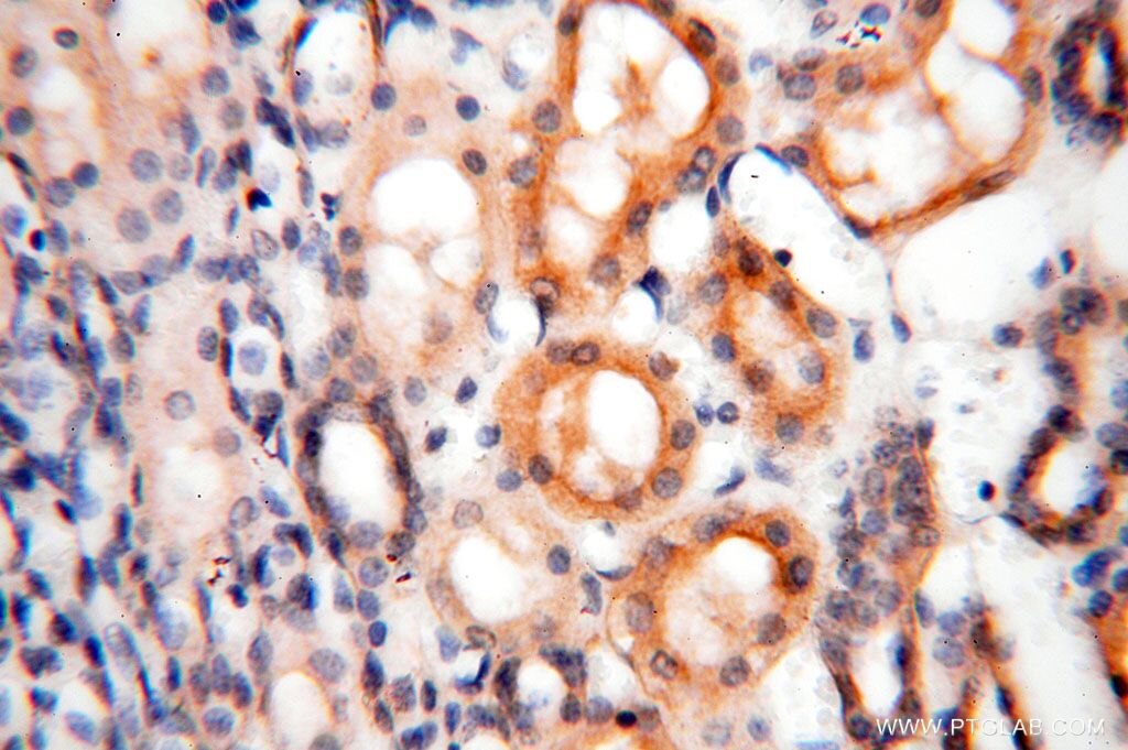 IHC staining of human kidney using 17047-1-AP