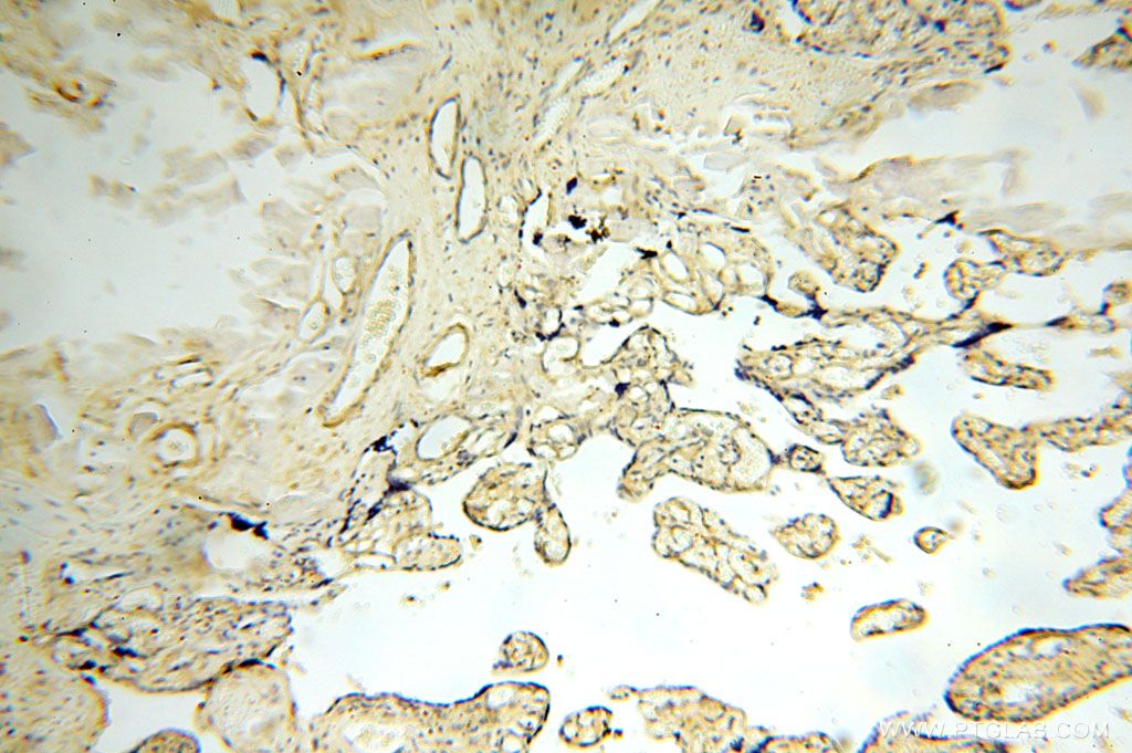 IHC staining of human placenta using 17047-1-AP