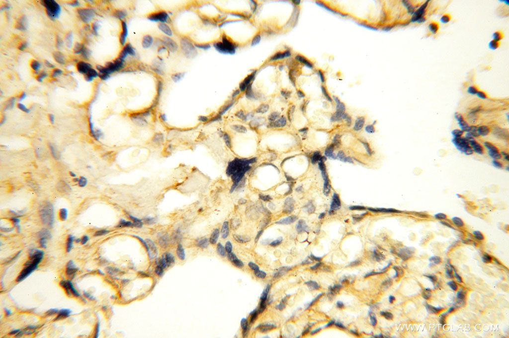 Immunohistochemistry (IHC) staining of human placenta tissue using ROGDI Polyclonal antibody (17047-1-AP)