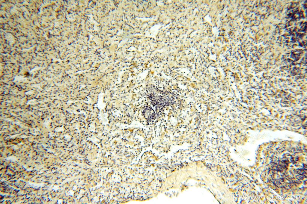 Immunohistochemistry (IHC) staining of human spleen tissue using ROGDI Polyclonal antibody (17047-1-AP)