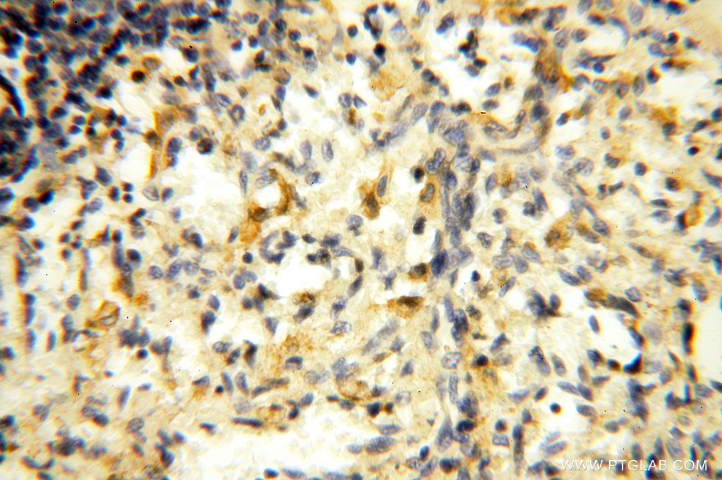 Immunohistochemistry (IHC) staining of human spleen tissue using ROGDI Polyclonal antibody (17047-1-AP)