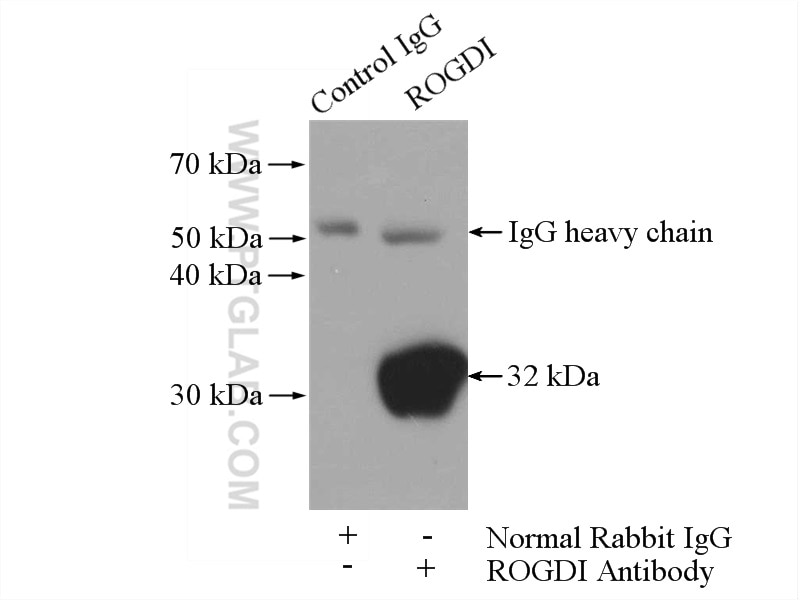 Immunoprecipitation (IP) experiment of mouse brain tissue using ROGDI Polyclonal antibody (17047-1-AP)