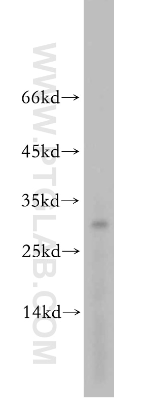 Western Blot (WB) analysis of mouse brain tissue using ROGDI Polyclonal antibody (17047-1-AP)