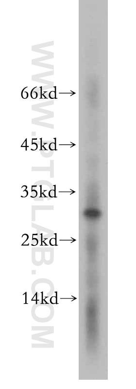 Western Blot (WB) analysis of mouse brain tissue using ROGDI Polyclonal antibody (17047-1-AP)