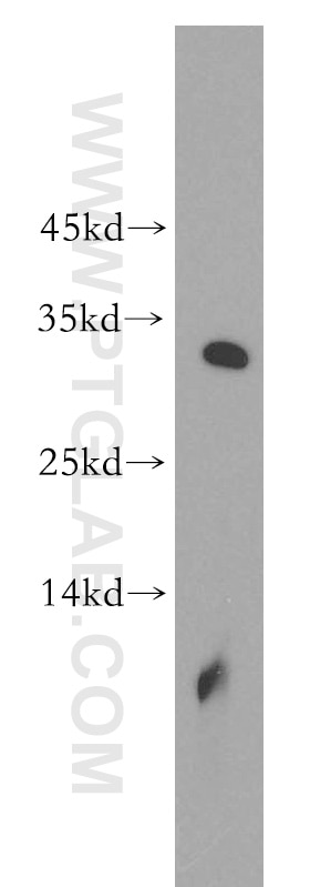 Western Blot (WB) analysis of human brain tissue using ROGDI Polyclonal antibody (17047-1-AP)