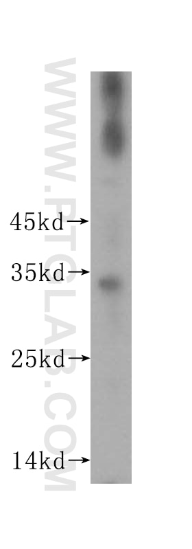 Western Blot (WB) analysis of human kidney tissue using ROGDI Polyclonal antibody (17047-1-AP)