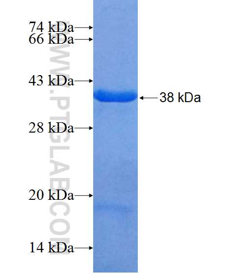 ROGDI fusion protein Ag10670 SDS-PAGE