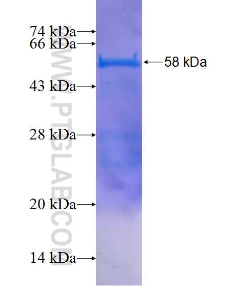 ROGDI fusion protein Ag10688 SDS-PAGE