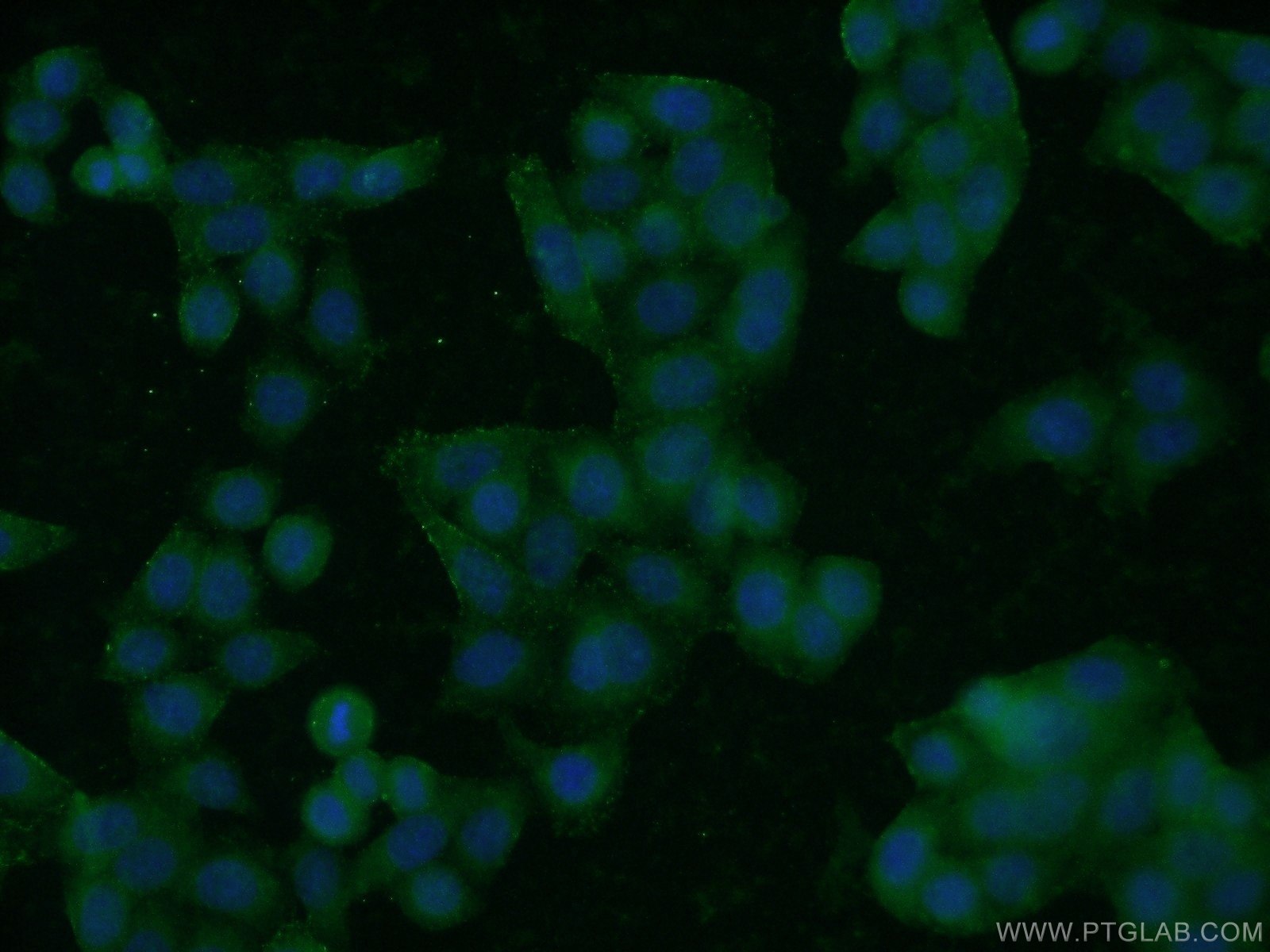 Immunofluorescence (IF) / fluorescent staining of HeLa cells using ROM1 Polyclonal antibody (21984-1-AP)