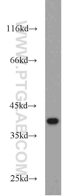 ROM1 Polyclonal antibody