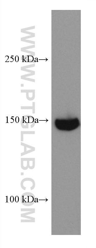Western Blot (WB) analysis of HeLa cells using RON, MST1R Monoclonal antibody (67954-1-Ig)