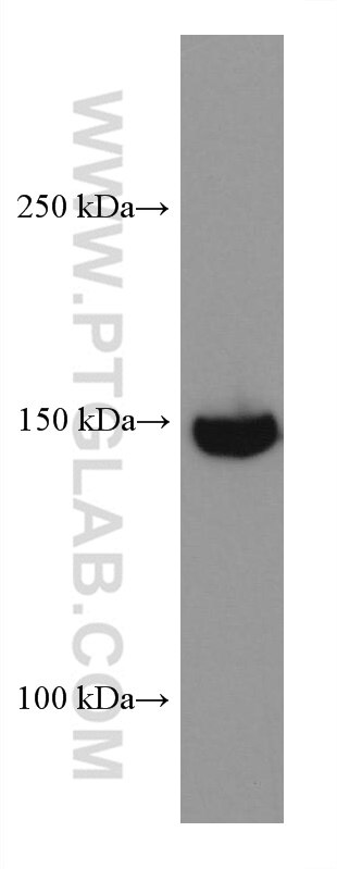 WB analysis of HeLa using 67954-1-Ig