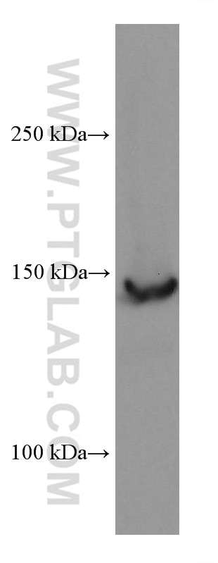 Western Blot (WB) analysis of PC-3 cells using RON, MST1R Monoclonal antibody (67954-1-Ig)