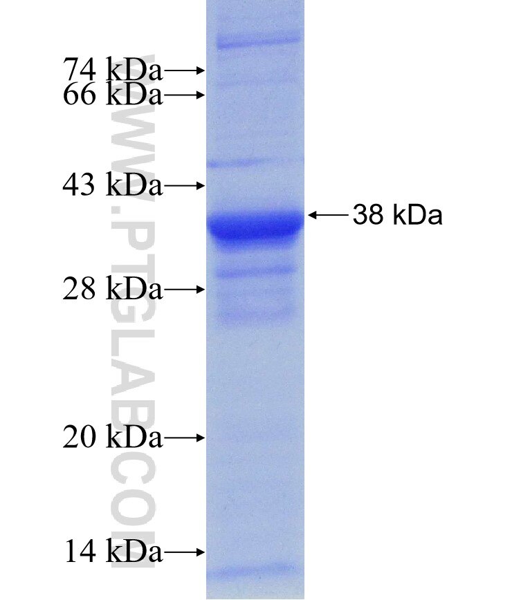 RON, MST1R fusion protein Ag28289 SDS-PAGE