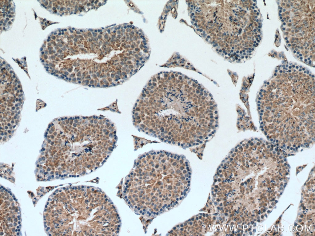 Immunohistochemistry (IHC) staining of mouse testis tissue using ROPN1L Polyclonal antibody (12565-1-AP)