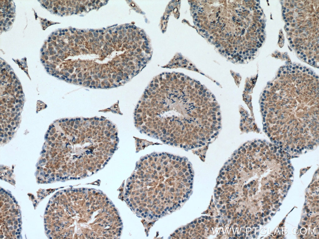 IHC staining of mouse testis using 12565-1-AP