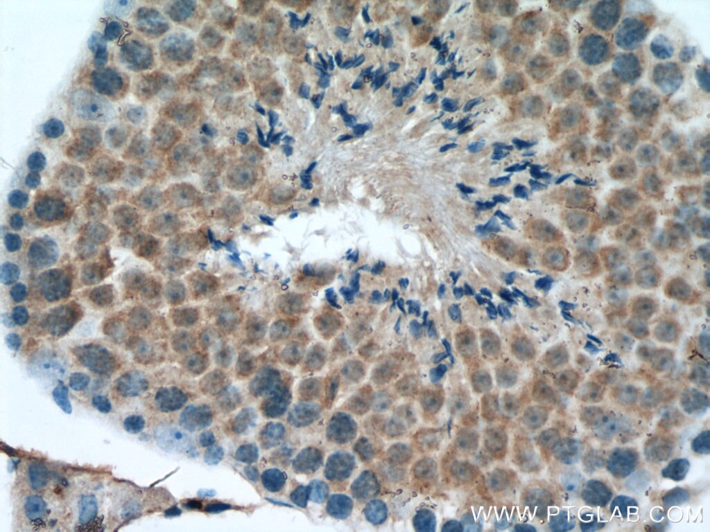 IHC staining of mouse testis using 12565-1-AP