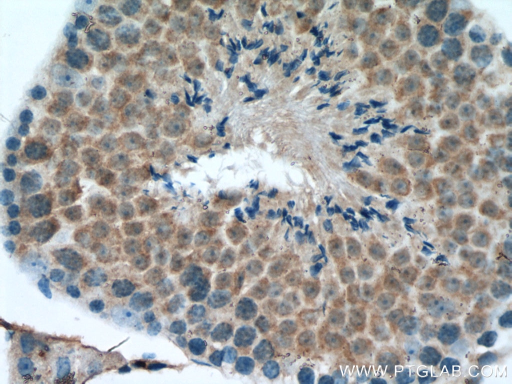 Immunohistochemistry (IHC) staining of mouse testis tissue using ROPN1L Polyclonal antibody (12565-1-AP)