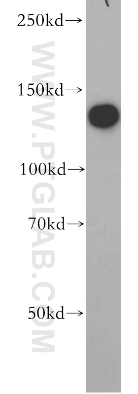 Western Blot (WB) analysis of K-562 cells using ROR1 Polyclonal antibody (20629-1-AP)