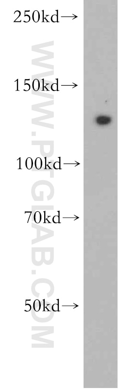 Western Blot (WB) analysis of HeLa cells using ROR1 Polyclonal antibody (20629-1-AP)