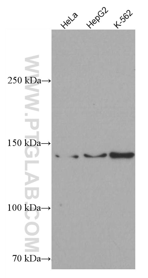 Western Blot (WB) analysis of various lysates using ROR1 Monoclonal antibody (66923-1-Ig)