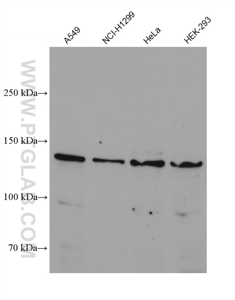 Western Blot (WB) analysis of various lysates using ROR1 Monoclonal antibody (66923-1-Ig)