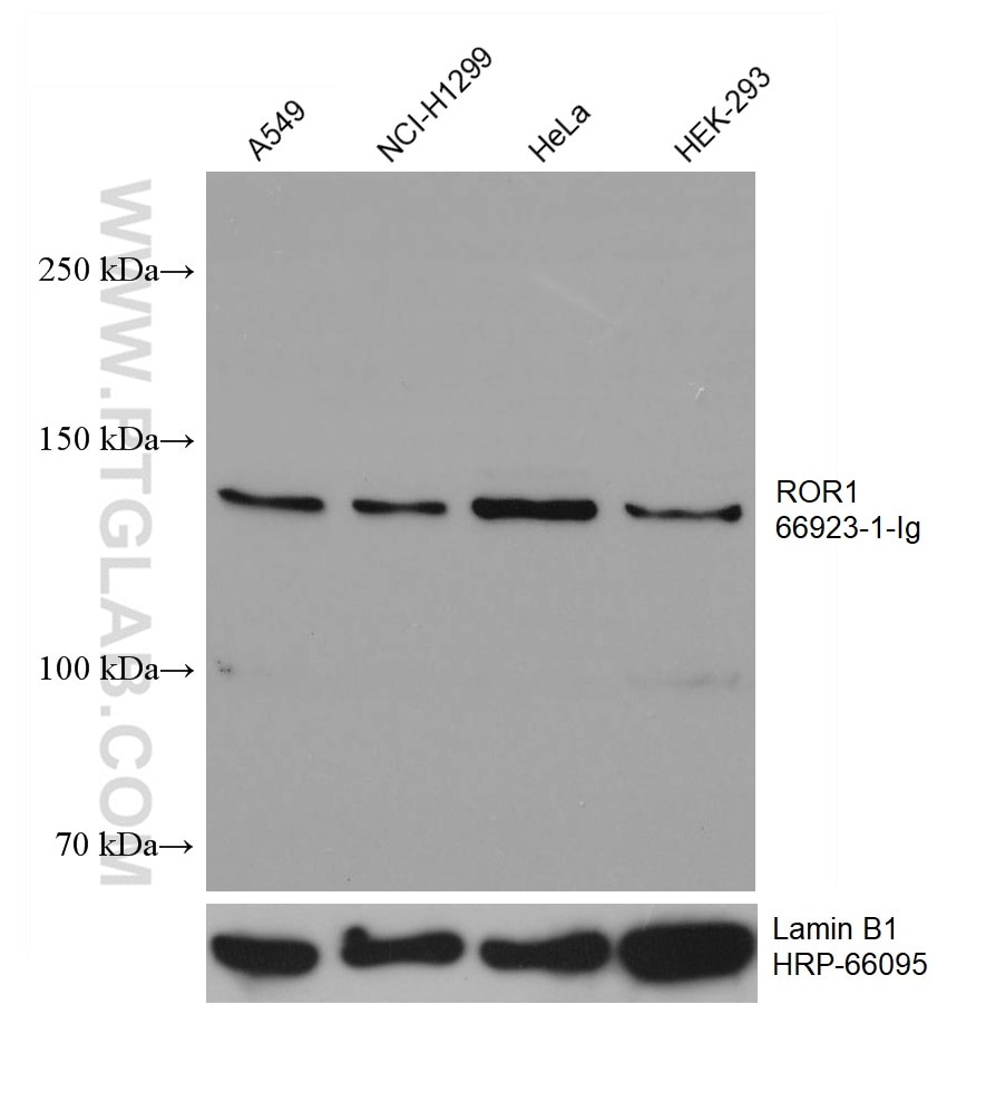 Western Blot (WB) analysis of various lysates using ROR1 Monoclonal antibody (66923-1-Ig)