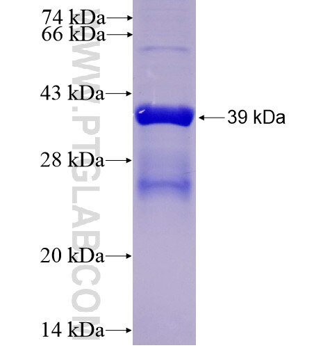 ROR1 fusion protein Ag14586 SDS-PAGE